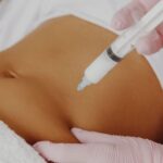 Rhinoplasty Before and After: What to Expect from Your Nose Job Journey