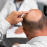 Dental Implant Treatment and Its Importance for Missing Teeth