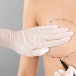 Best Breast Augmentation Surgery Without Visible Scars
