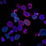 Creative Enzymes Amplifies Biochemical Research with the Launch of Native Roxburgh Superoxide Dismutase
