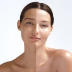 Skin Whitening Capsules Benefits Uses and Complete Guide for Glowing Skin
