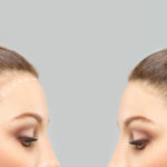 How to Select a Qualified Female Hair Transplant Surgeon