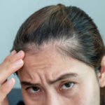 Smart Beauty Choices: A Practical Guide to Botox Injection Price in Pakistan