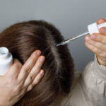 Unshaven Hair Transplants: A Game Changer for Women